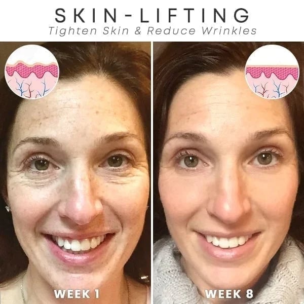 š„Botox Face Serum