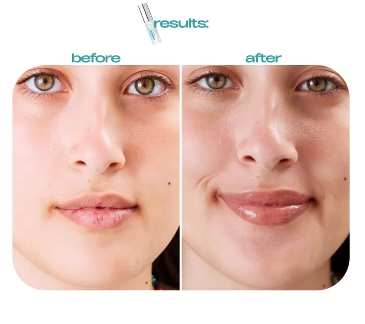 Last Day 50%OFF💥BP Spicule Plumping Lip Serum Moisturizing Lip Oil