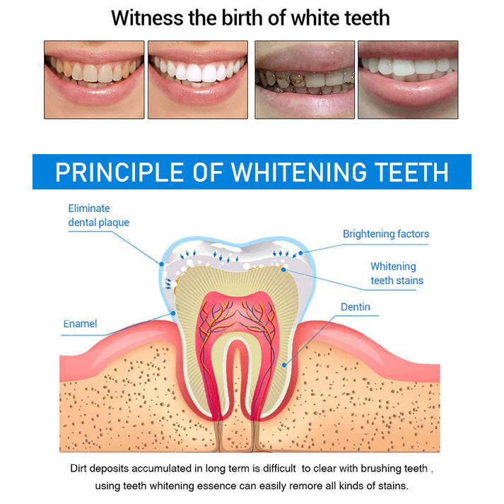 BUY 1 GET 1 FREE | Teeth Whitening Essence
