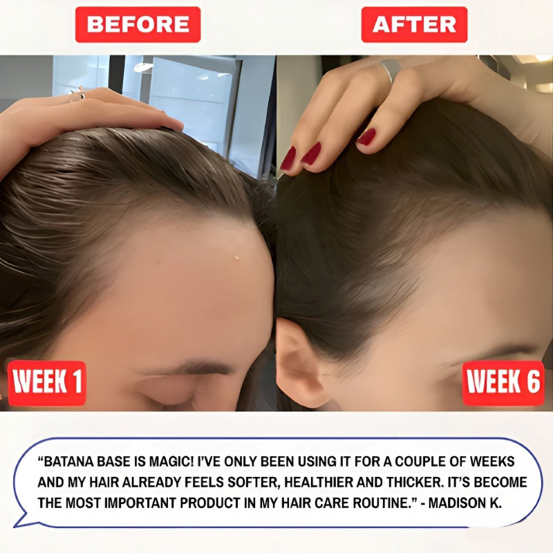 🔥Last Day 50% Off🔥Batana Natural Hair Growth Oil