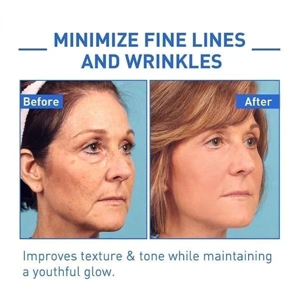 š„Botox Face Serum