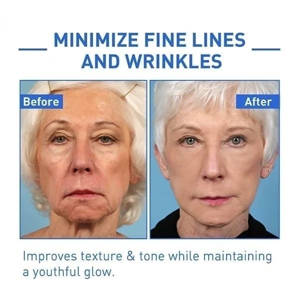 š„Botox Face Serum