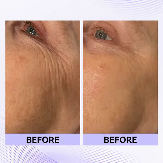 Last Day 50% OFFđ„The Vita-A Retinal Shot Tightening Booster