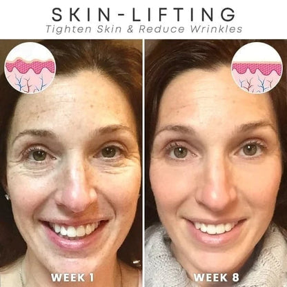 🔥Botox Face Serum