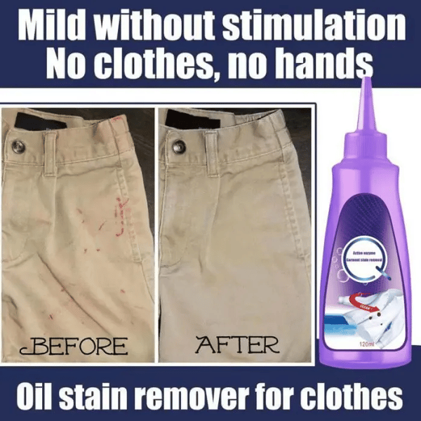✨ Active Enzyme Laundry Stain Remover 👕