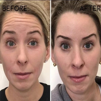 🔥Botox Face Serum