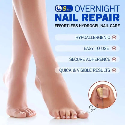 🔥Last Day 55% Off🔥 Fungal Nail Repair Patches