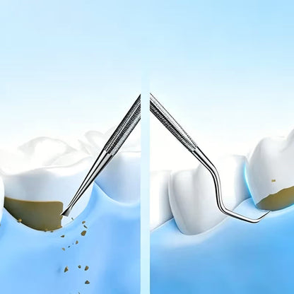 😁Ultrasonic Teeth Whitening Cleaner Set