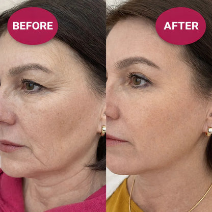 ⏰LAST DAY BUY 3 GET 2 FREE!!💝Calcium Volume Balm💫Anti-Aging & Firming Korean Skincare Stick🔥