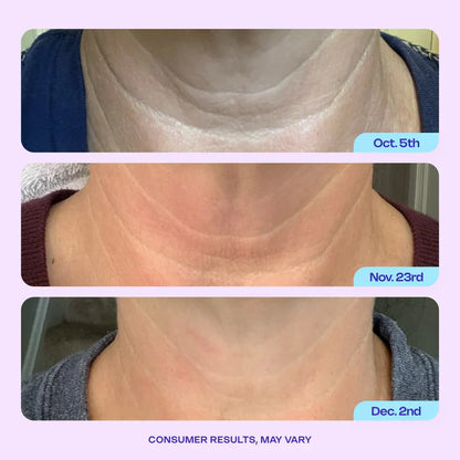 Advanced Firming Neck Cream – Visibly Lifts & Tightens