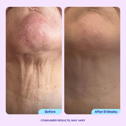 Advanced Firming Neck Cream – Visibly Lifts & Tightens