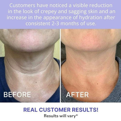 Advanced Firming Neck Cream – Visibly Lifts & Tightens