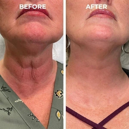 🔥Botox Face Serum